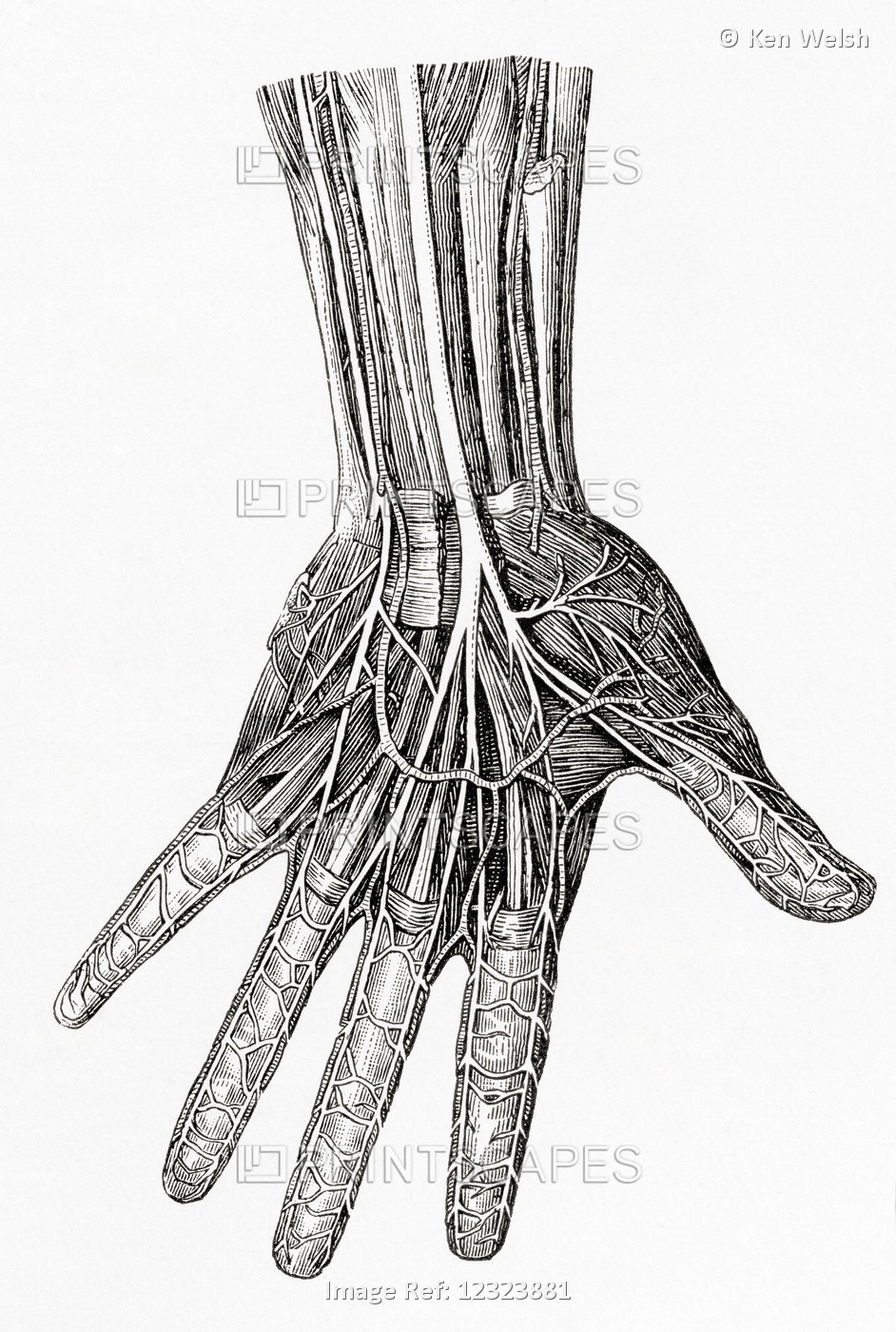 Diagram Showing The Nerves Of The Human Hand.  From Meyers Lexicon, Published ...